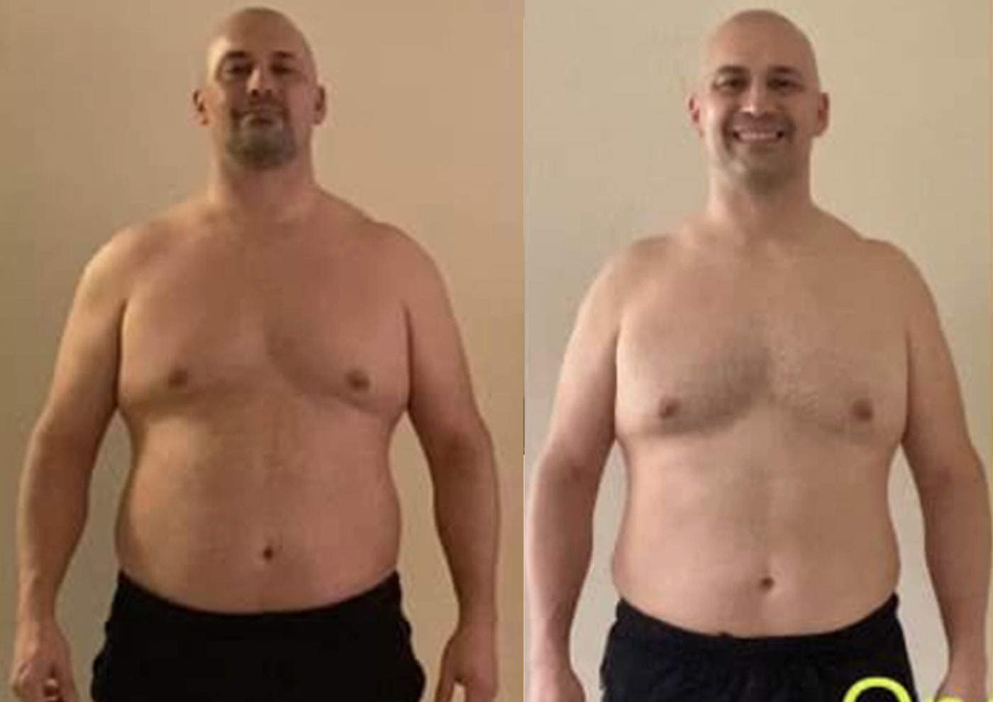 weightloss